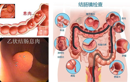 萎縮性胃炎真的“很?chē)樔恕?？看完這“七個(gè)事實(shí)”你就明白了