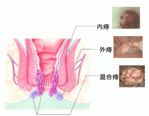 南寧肛腸醫(yī)院